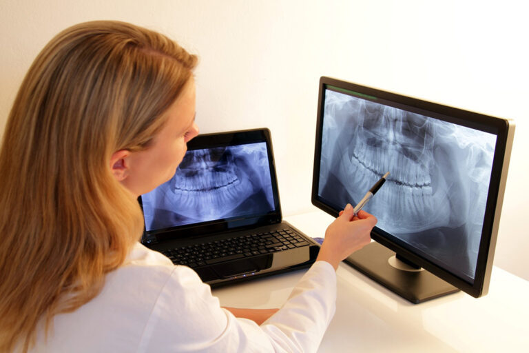 Dental X Rays in Pitt Meadows, BC Marigold Dental Clinic